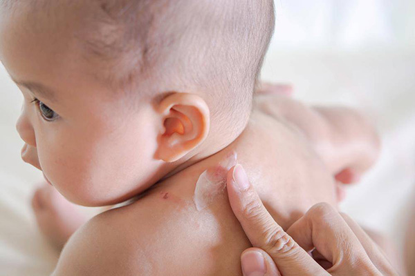 Nên cho trẻ sơ sinh sử dụng kem dưỡng ẩm để làn da của bé được cấp ẩm mịn màng